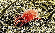 Los ácaros del polvo son criaturas de ocho patas que no muerden ni causan enfermedades, y, como podría adivinar, viven en partículas de polvo.