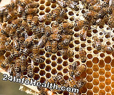 Honning kan efterhånden udsætte kroppen for allergener, som kunne immunisere en person mod allergi.