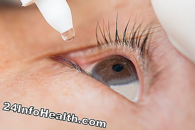Det visar en person med akut allergisk konjunktivit, som upplever en klar eller vit ögonutsläpp.