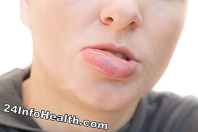 Enfermedades y condiciones: Síntomas moderados de la hinchazón de la cara, causas y preguntas comunes