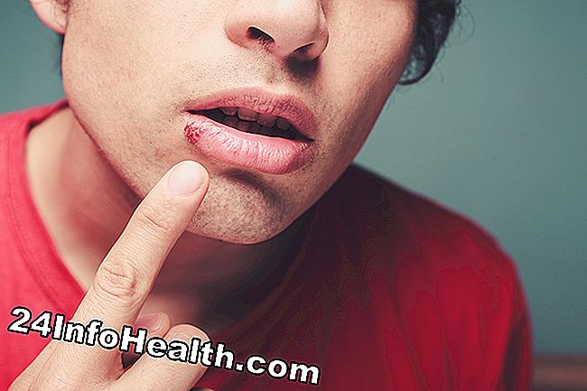 Nó được mô tả một người bị đau lạnh, người đang trải qua một miệng đau giống như herpes miệng.