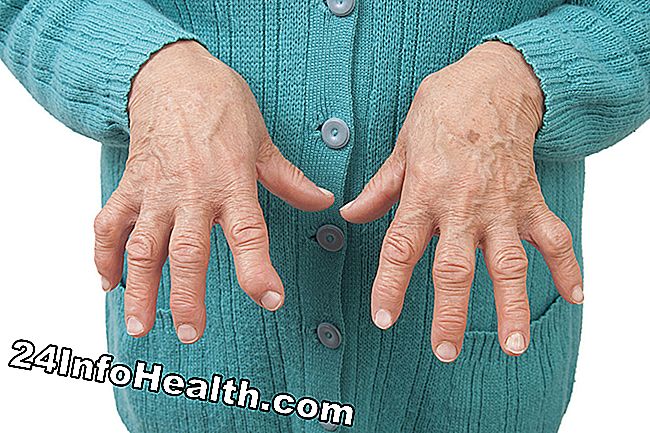 เป็นภาพบุคคลที่มีโรคข้ออักเสบรูมาตอยด์ที่กำลังประสบกับอาการปวดในมือทั้งสองข้าง