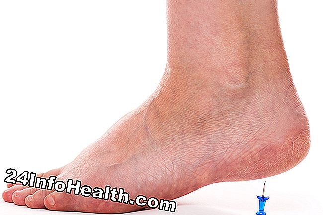 Es zeigt eine Person mit Plantarfasziitis, die einen Fußschmerz hat.