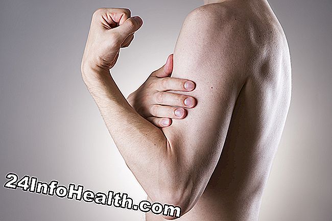 Det skildrer en person med bicep blå mærke, der oplever smerter i overarmen.