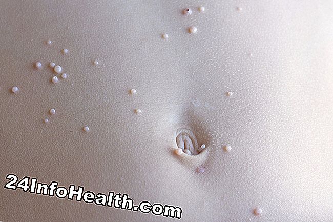 Det visar en person med genital herpes, som upplever en vagina klump.