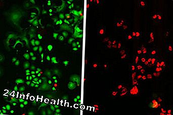 Fotomikrografer viser hvordan nanorør kan selektivt lokalisere og ødelegge HER2 brystkrefttumorer. Tumorceller til venstre ble behandlet bare med antistoffer og deretter bestrålt, mens de til høyre ble behandlet med et kompleks av antistoffer og nanorør og deretter bestrålt. Røde områder viser hvor cellene er drept.