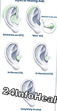 Conceptos básicos de audífonos: audífono