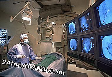 Los médicos utilizarán imágenes cerebrales para colocar el láser cerca del coágulo de sangre.