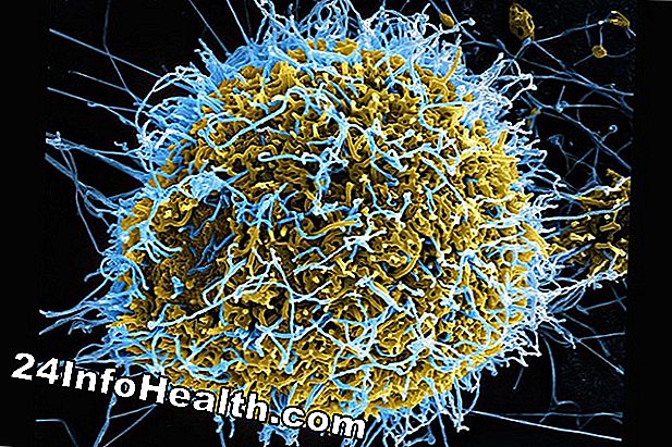 Sygdomme og tilstande: Hvordan Ebola virker