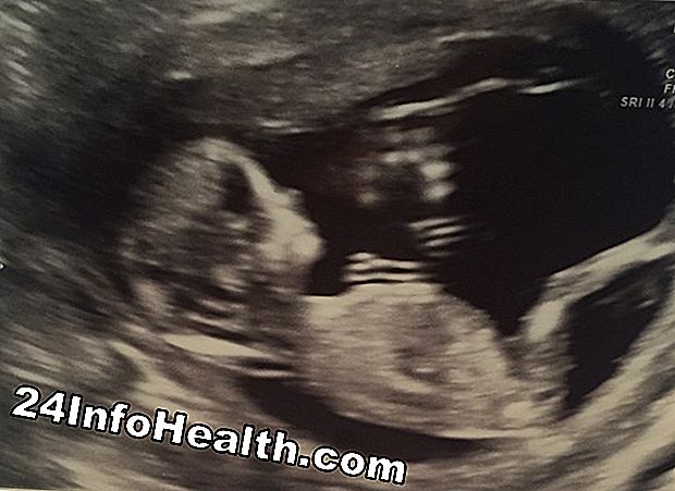 Graviditet og forældre: 10 Tips til en sund graviditet