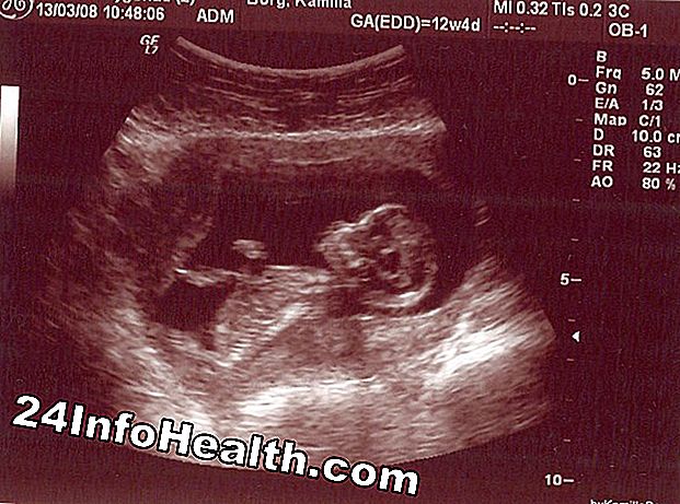 Graviditet og forældre: Guide til at være 10 uger gravid
