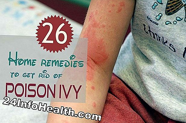 17 Home Remedies For Poison Ivy 