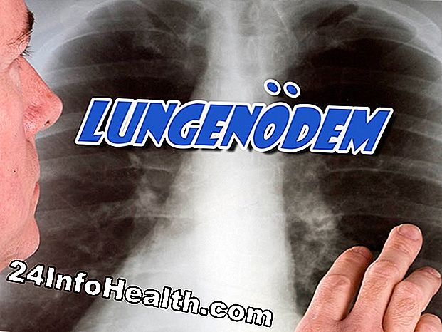 Krankheiten und Bedingungen: Was ist Lungenödem?