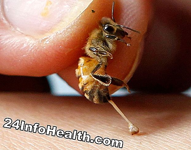 Medisin: Hvordan Bee Sting Therapy Works