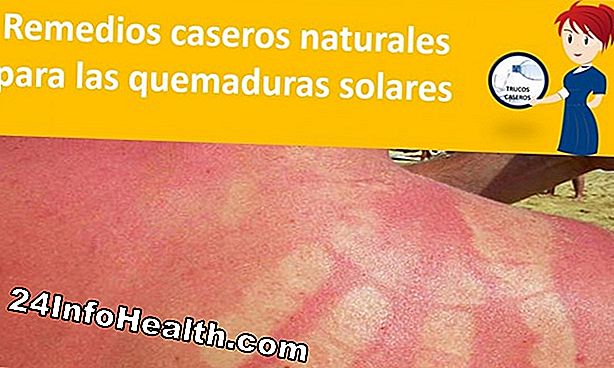 Protección de la piel: 10 Remedios caseros para las quemaduras solares