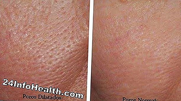 Protección de la piel: Poros de la piel