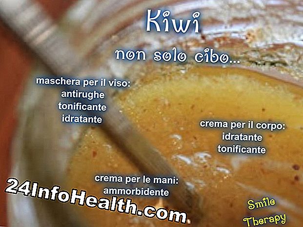 Benessere: Kiwi: cibo naturale per perdere peso