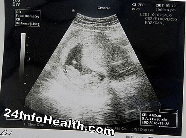 Kehamilan & keibubapaan: Panduan Menjadi 13 Minggu Hamil