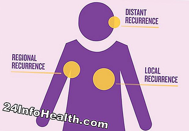 Ziekten en aandoeningen: Breast Cancer Resources en organisaties