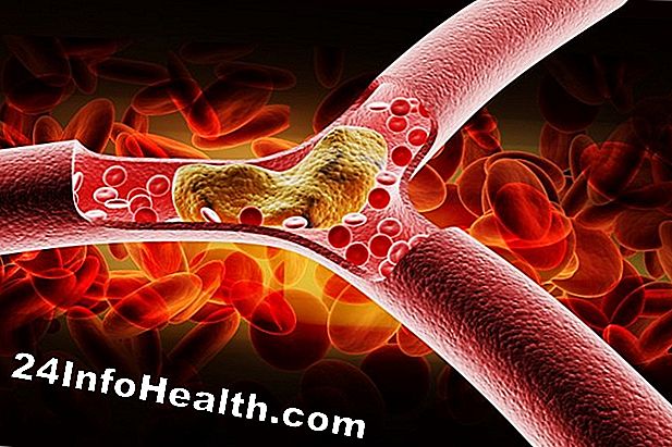 Doenças e condições: Níveis de colesterol