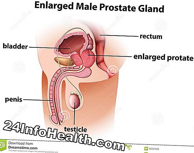 Sexuell hälsa: Prostatakörtel