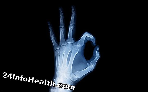 โรคและเงื่อนไข: X-ray จะช่วยในการตรวจหาโรคซาร์สได้หรือไม่?