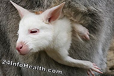 Animais com albinismo como este wallaby geralmente ficam à sombra para proteger a pele da luz solar.