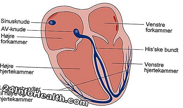 Sygdomme og tilstande: Hvad anses en langsom hjertefrekvens? 10 langsomt hjertefrekvens årsager