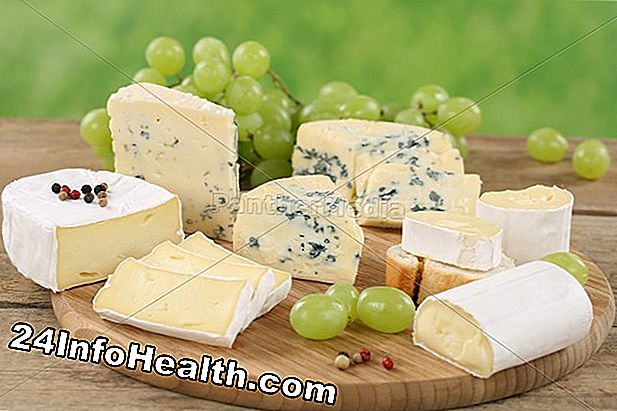 Käse - wie vaginaler Geruchssymptome, Ursachen und häufig gestellte Fragen