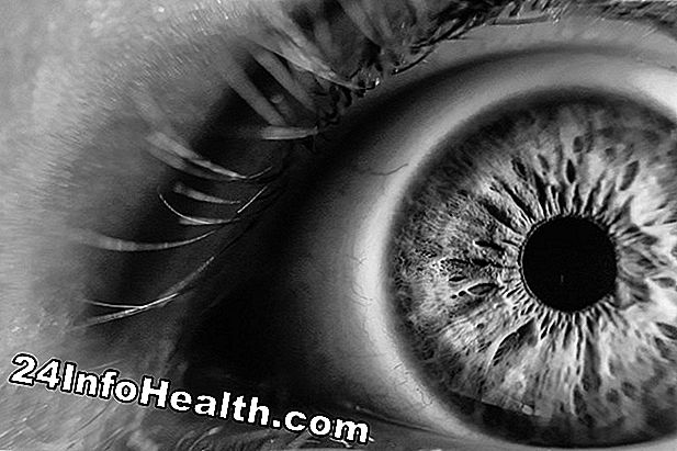 Krankheiten und Bedingungen: Morgen Augenkruste Symptome, Ursachen und häufig gestellte Fragen