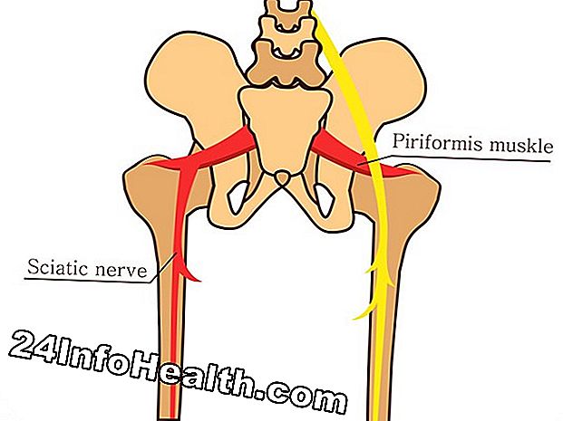 Krankheiten und Bedingungen: Schmerzen in einem Knie Symptome, Ursachen und häufig gestellte Fragen