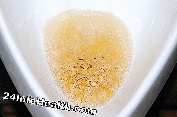 Krankheiten und Bedingungen: Gründe für Trübe Urin: Symptome von Trübe Urin verstehen