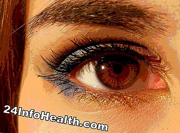 Enfermedades y condiciones: Alergias, fatiga ocular, conjuntivitis: 10 causas de dolor en el ojo izquierdo y derecho
