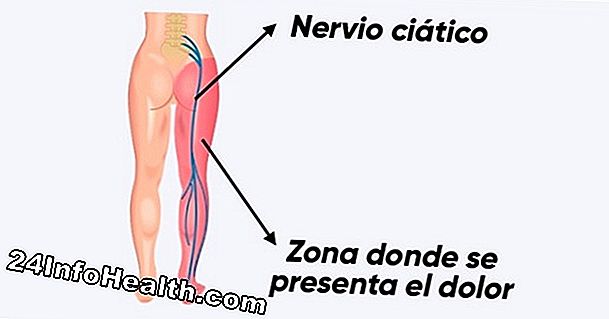 Síntomas, causas y preguntas comunes de la parte inferior de la pierna