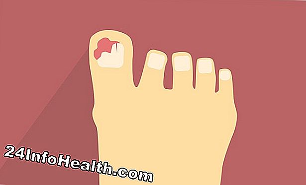 Enfermedades y condiciones: Agudo, dolor punzante del dedo gordo? Causas y tratamiento del dolor de dedo gordo