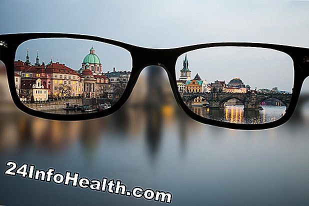 Sintomo unilaterale del bulbo oculare, cause e domande