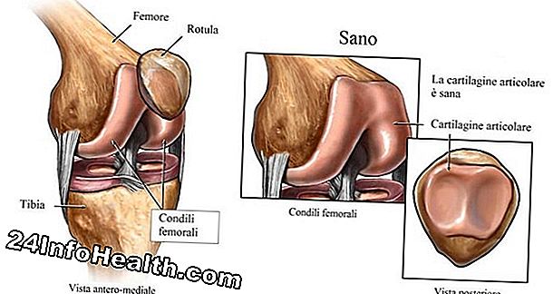 Malattie e condizioni: Cause e trattamenti del dolore alla coscia anteriore, interno, superiore e esterno