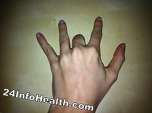 Dor no meio da junta dos dedos sintomas e causas