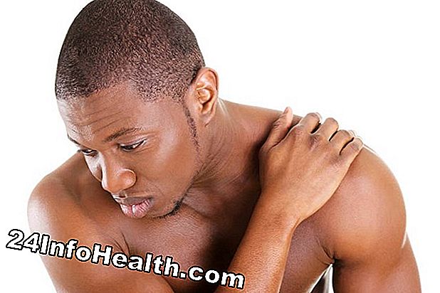 Doenças e condições: Sintomas rígidos do ombro, causas e perguntas comuns