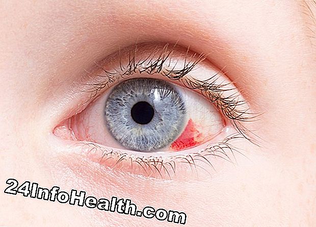Sintomas de Olhos Secos, Causas e Perguntas Comuns