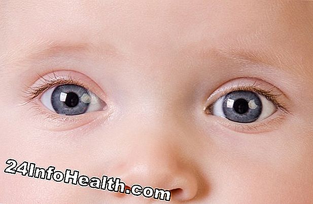 Doenças e condições: Sintoma de Descarga do Olho Claro ou Branco, Causas e Perguntas