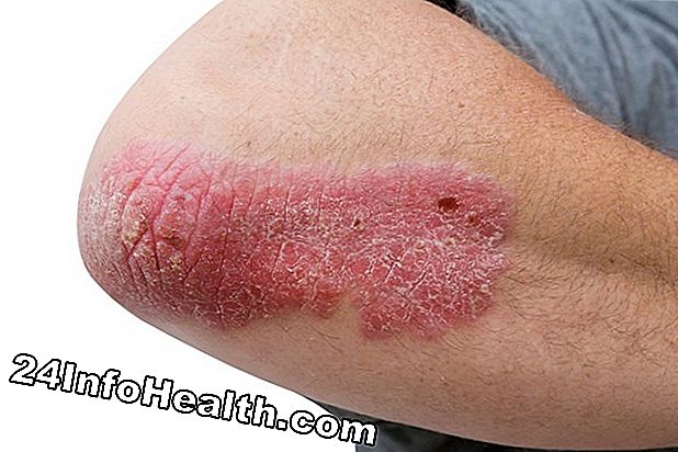 Elbow Itch Symptom, orsaker och vanliga frågor