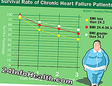 Fedme paradoksforskning viser, at overvægtige mennesker med kroniske sygdomme har tendens til at leve længere end raske mennesker.