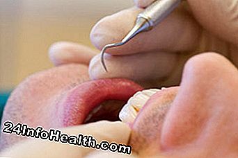 La determinación de la raíz del problema a menudo requiere una visita, y a veces el tratamiento del dentista.